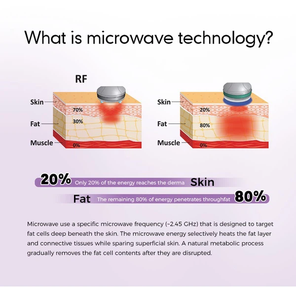 microwave sculpting therapy microwave sculpting therapy